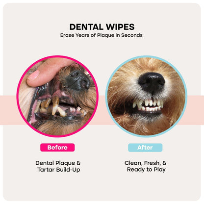 Uprost PureCare™ Kit